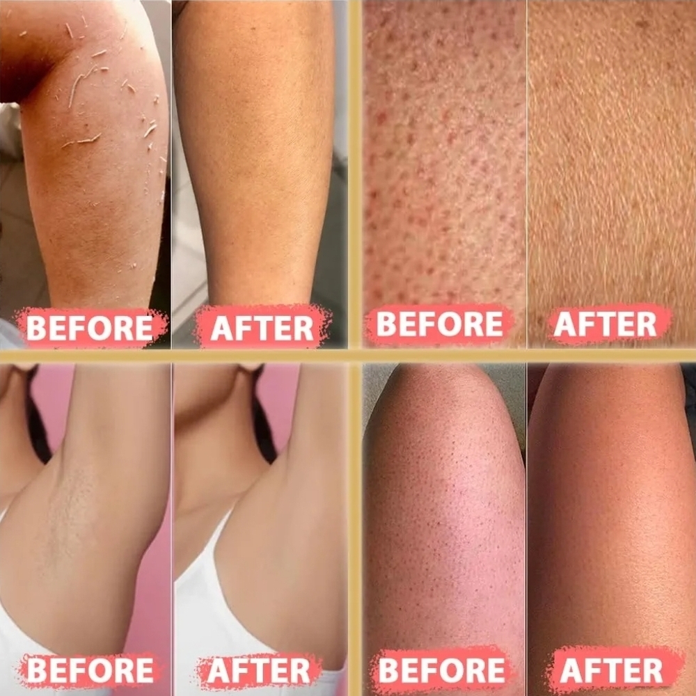 Turkish Premium Natural Exfoliating Kese, Mitten Smooth Your Skin
